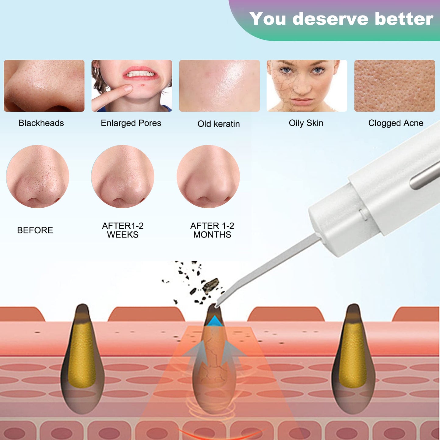 Facial Skin Care Tools,Skin Scrubber Spatula Blackhead Remover Pore Cleaner with 5 Modes and LCD Digital Display,Comedones Extractor for Facial Deep Cleansing Scraper